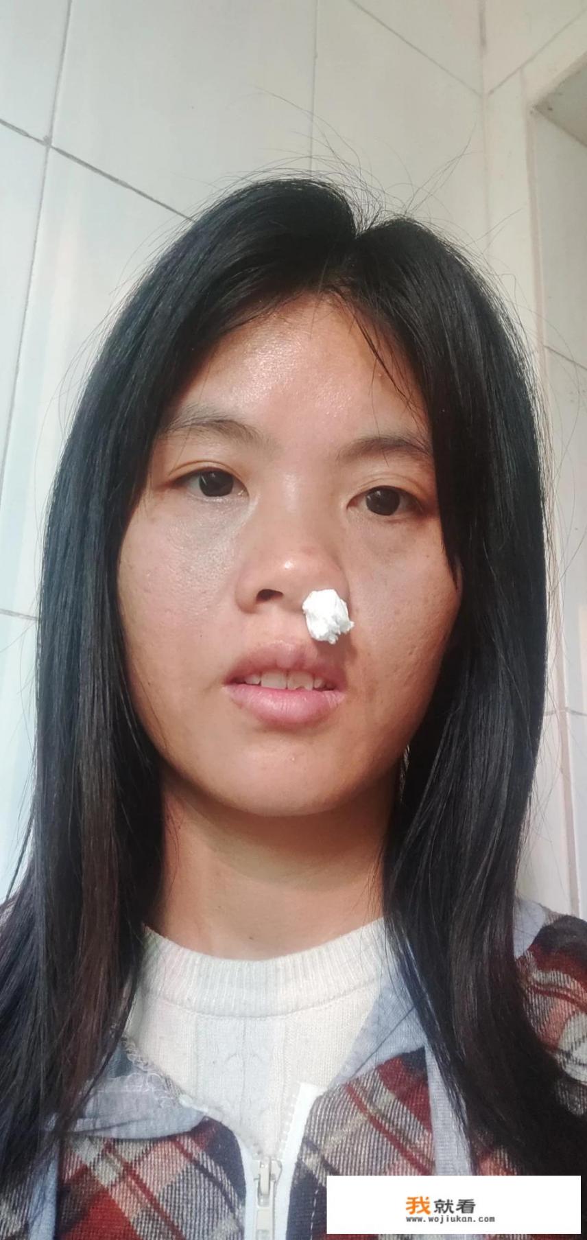 女，28，早上起床以后流鼻血_孩子住在装修了七年的房子，却遗憾患上白血病，甲醛没办法去除吗