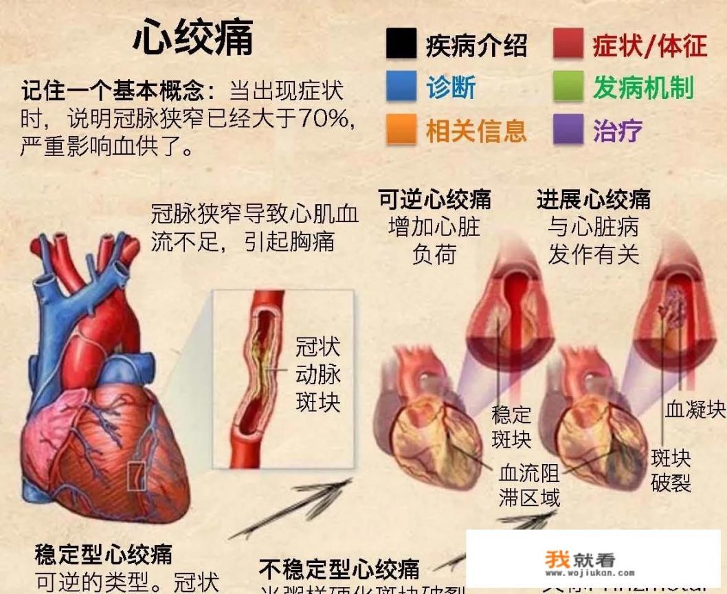 什么是心绞痛