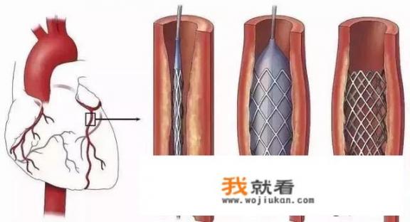 西藏摩托手机支架会颠滑吗？