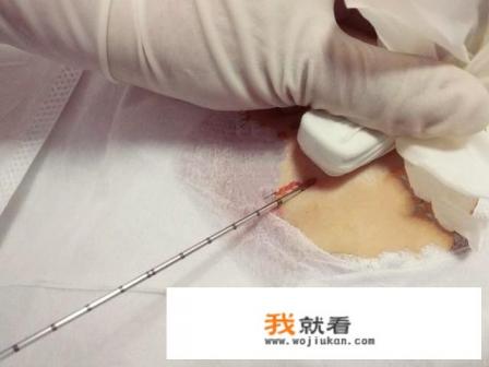 阴唇长一粒很大粒硬硬的是什么东西有时候痒挤压的时候会痛？