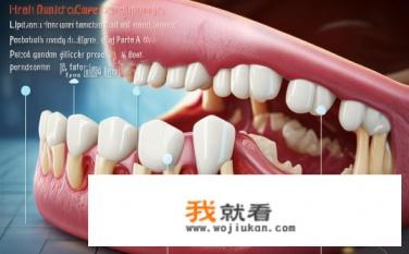 牙周炎是什么？牙周炎的本质与机制是什么?