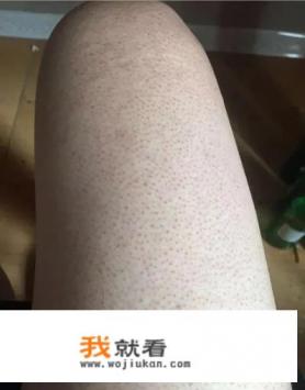 又鸡身上发红是什么？