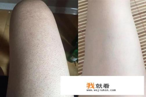 又鸡身上发红是什么？