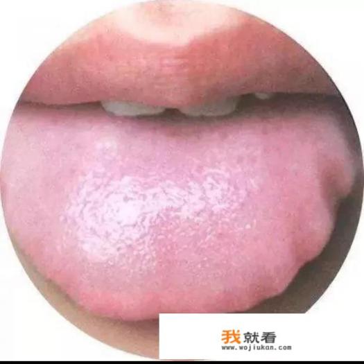 健脾药有哪些？