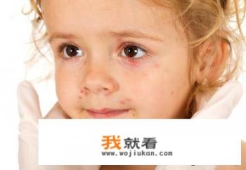 糖尿病人能喝乌骨鸡汤吗？