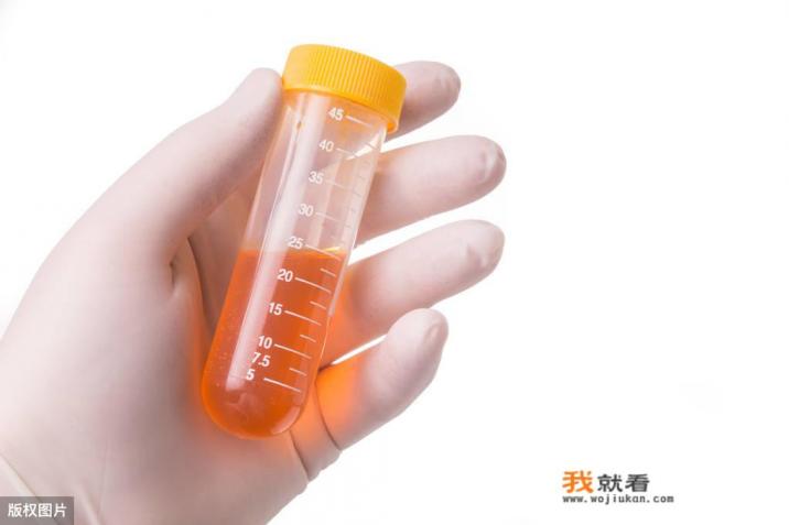 得了脂肪肝在饮食方面要注意些什么？