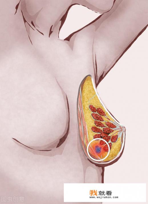 乳腺增生结节怎么消除？
