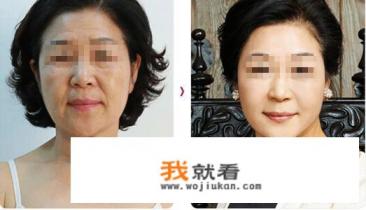 小拉皮手术做多长时间? 小拉皮手术做多长时间?