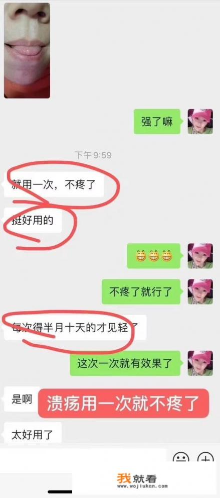 经常上火脸上长痘痘嘴巴口腔溃疡吃什么药可以下火？