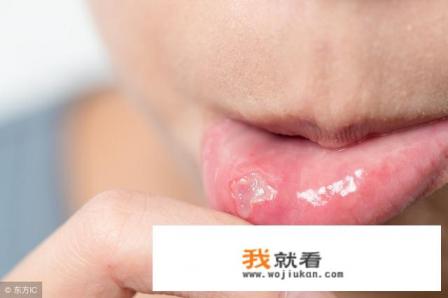 经常上火脸上长痘痘嘴巴口腔溃疡吃什么药可以下火？