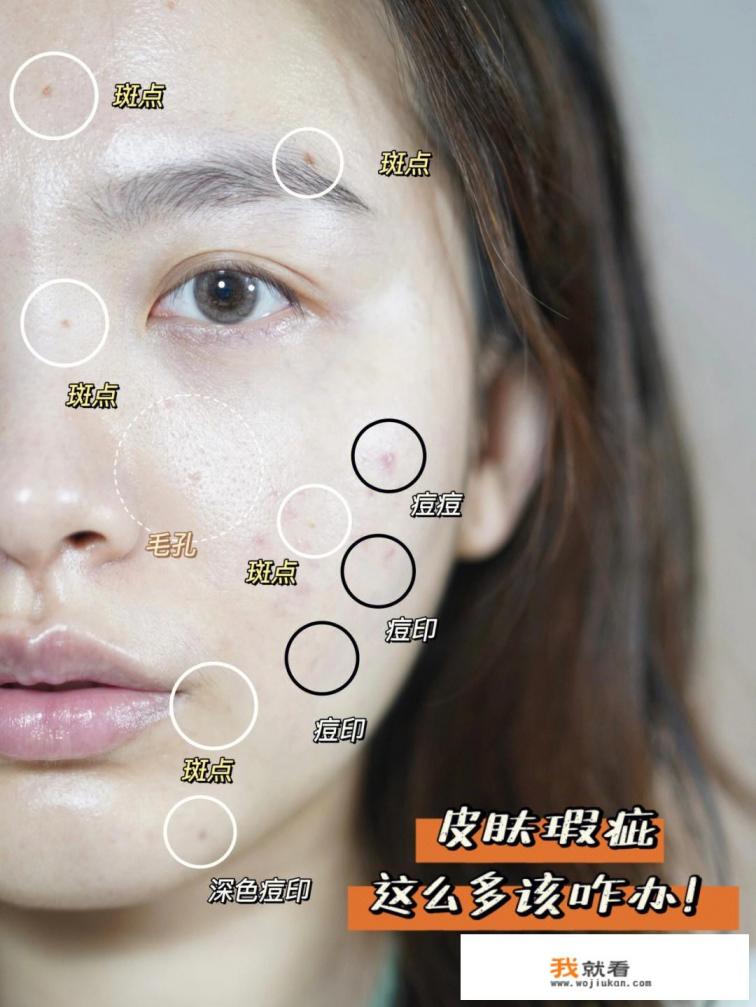 吃什么去斑效果最好？