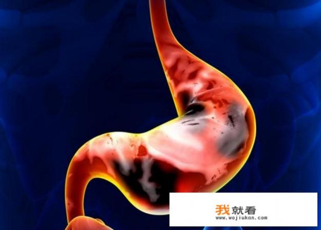 长期胃痛怎么快速缓解？