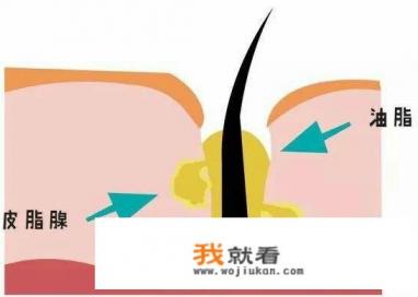 脸上痘痘、黑头超级多？还反反复复的，脸都要毁掉了，这都是螨虫的问题吗？