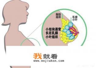 乳腺结节怎么治疗，乳腺结节可以消除吗？