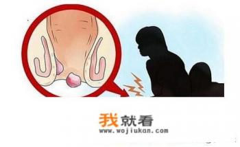痔疮长什么样？
