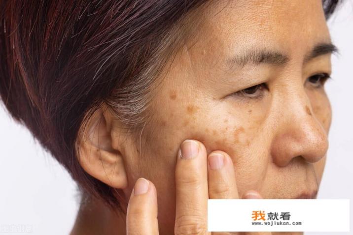 内调黄褐斑的办法是什么？