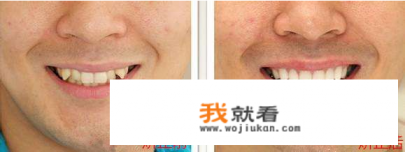 虎牙直播如何弄海报？