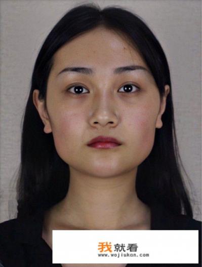 颧骨特别高，如何可以改善这个问题？如果做手术，有哪些好的医院推荐？