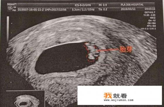 德国专博回国就业医生需要规培吗? 德国专博回国就业医生需要规培吗?