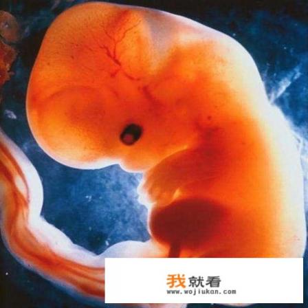 德国专博回国就业医生需要规培吗? 德国专博回国就业医生需要规培吗?