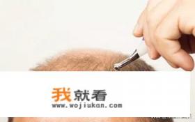 头顶脱发是什么原因？